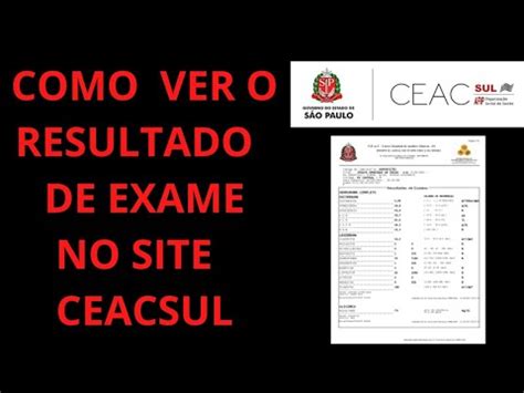 ceacsul exames resultados